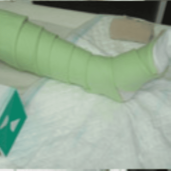 Rolo de Viscoelástico com manga