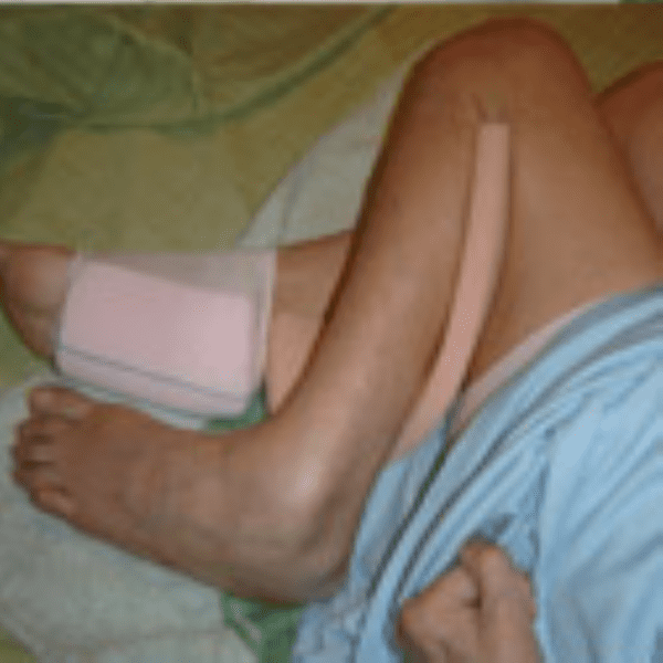 Rolo de Viscoelástico com manga