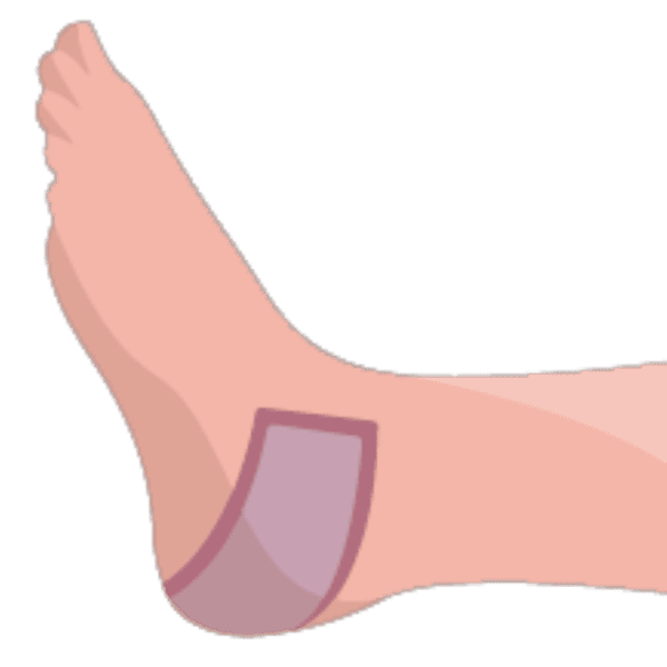 Rolo de Viscoelástico com manga